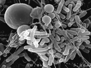 bifidobacterium-R175_big