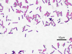 Bacillus_subtilis_Gram