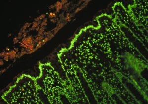 inserm_microbiote